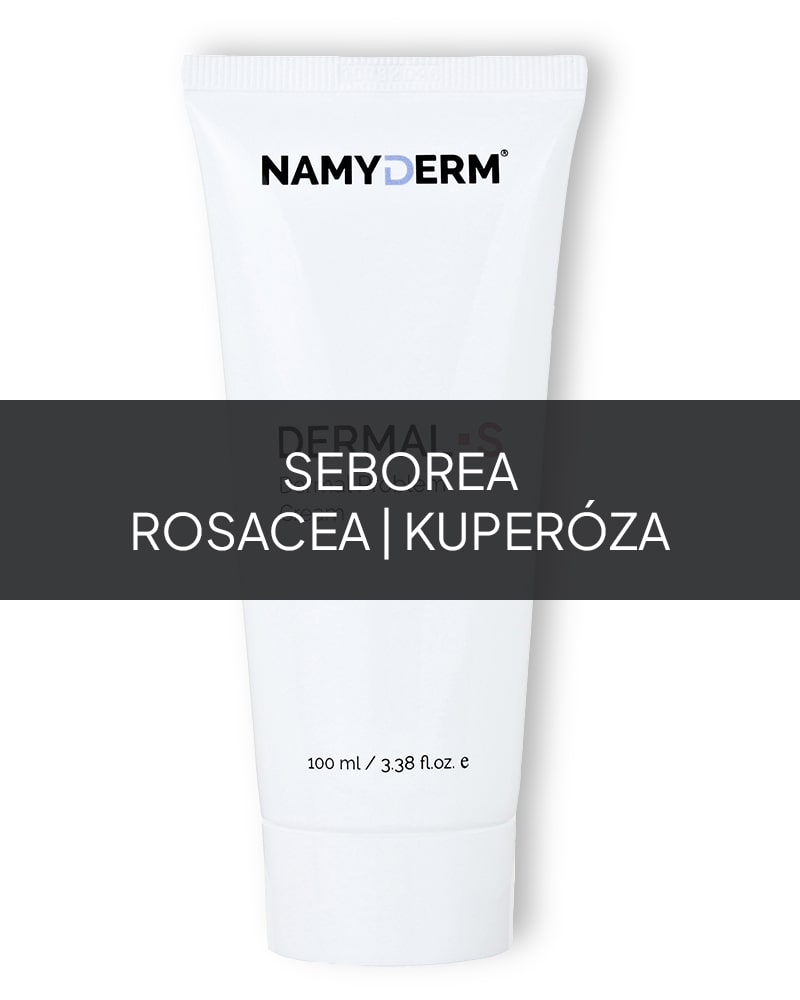 Dermal S – prírodný dermálny krém. Seborea, rosacea a kuperóza