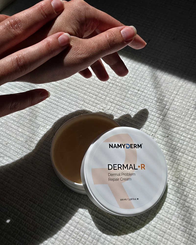 DERMAL R | Prírodný dermálny krém | Popraskaná pokožka | Ochrana pred zimou