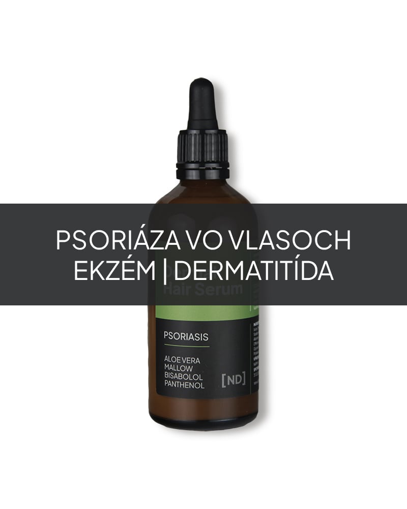 Prírodné vlasové sérum na psoriázu vo vlasoch