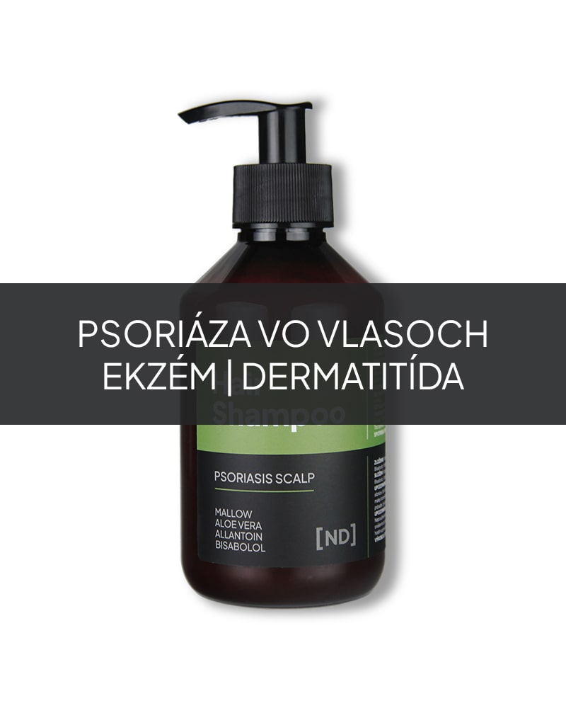 Prírodný šampón na psoriázu vo vlasoch