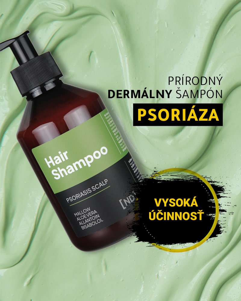 Šampón na psoriázu vo vlasoch - vysoká účinnosť